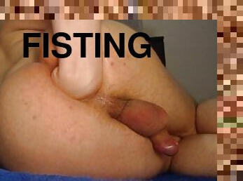 asiatisk, ekstrem, fisting, svær, anal, compilation, creampie, cum, knulling-fucking, nympho