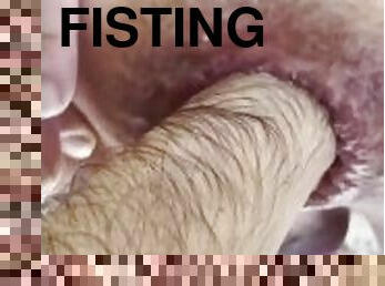 extremo, fisting, anal, hardcore, gay, pénis