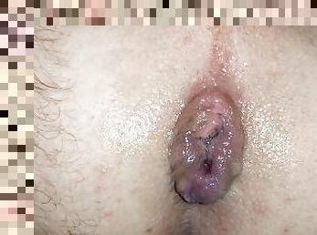 Prolapse husband anal